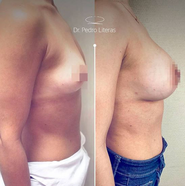 Slider image (6) Dr. Pedro Literas